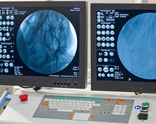 Angiografie
Angiography